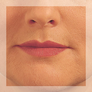 Lip Enhancement