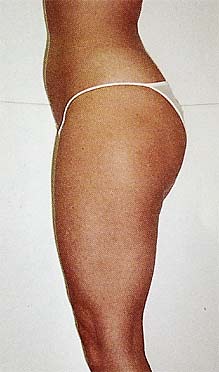 Example 3
