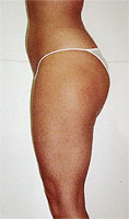 Example 3