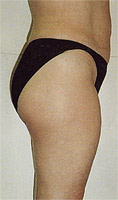 Example 4